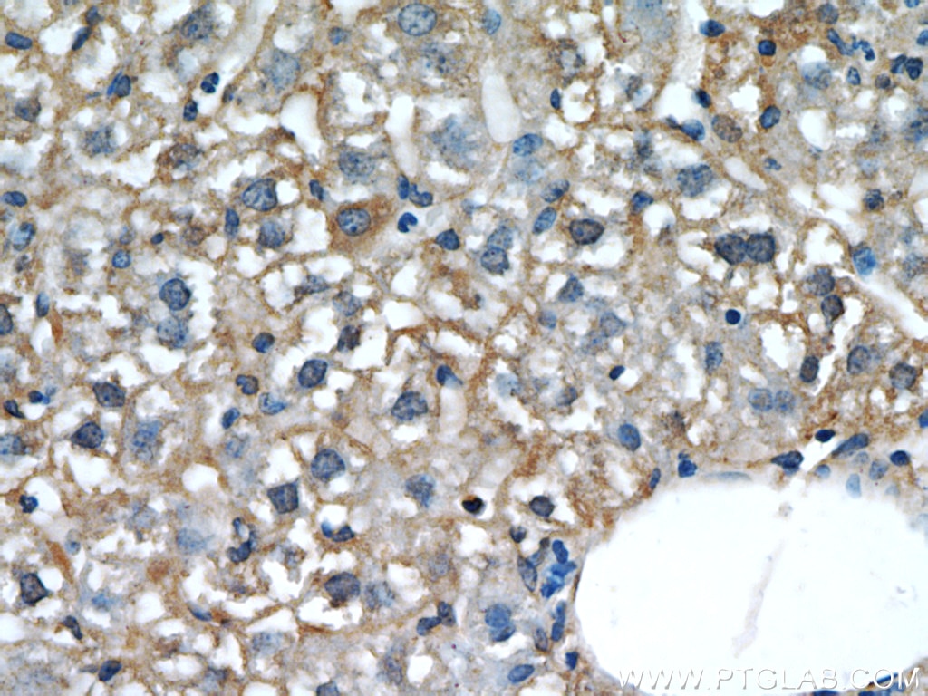 L-VOCC Polyclonal antibody