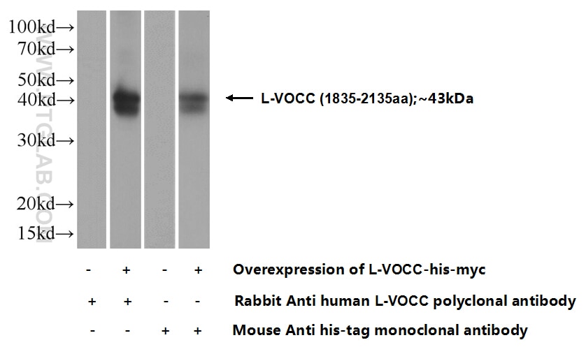 L-VOCC Polyclonal antibody