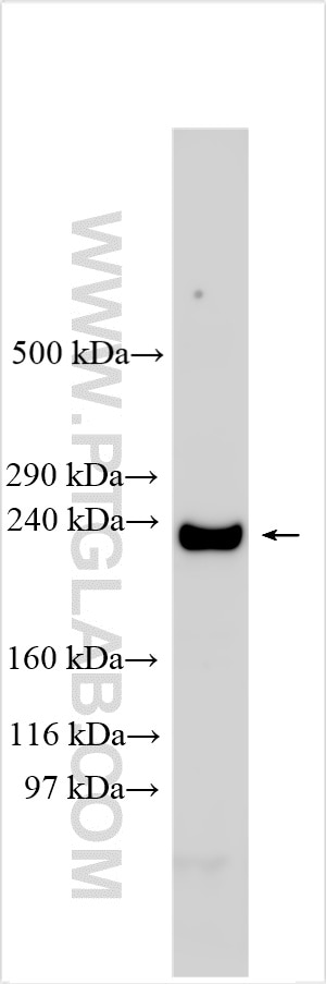 Western Blot (WB) analysis of various lysates using CACNA1C Polyclonal antibody (21774-1-AP)
