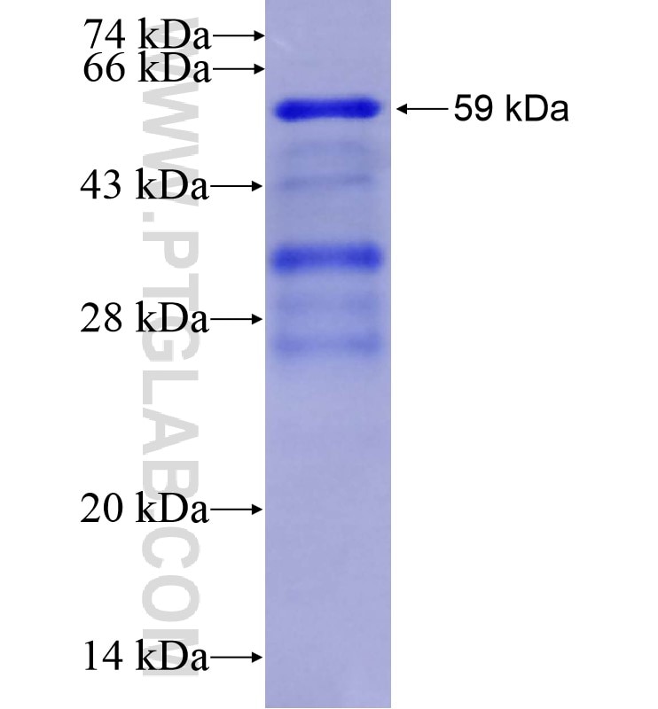 L-VOCC fusion protein Ag16455 SDS-PAGE