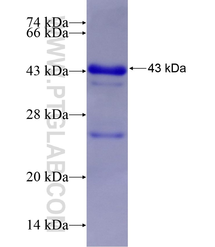L-VOCC fusion protein Ag17391 SDS-PAGE