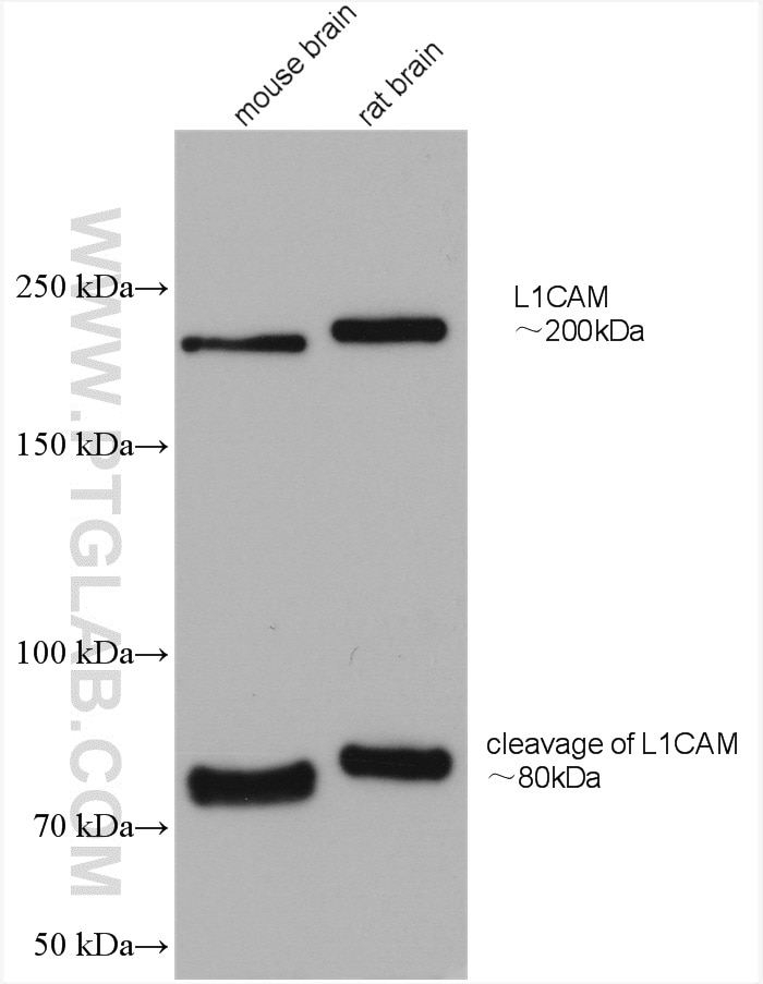 Western Blot (WB) analysis of various lysates using L1CAM Polyclonal antibody (20659-1-AP)