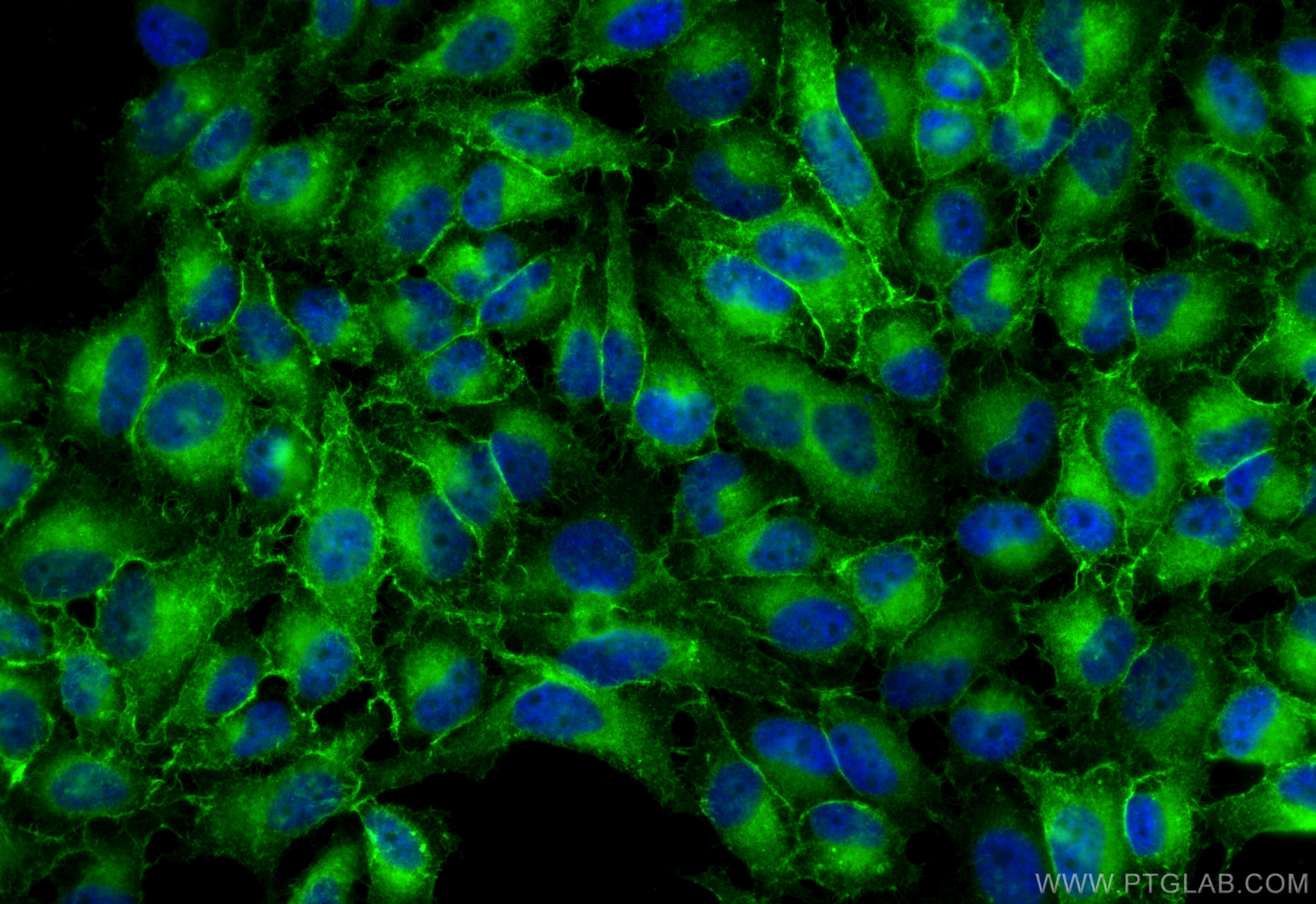 Immunofluorescence (IF) / fluorescent staining of HeLa cells using L1CAM Polyclonal antibody (31534-1-AP)