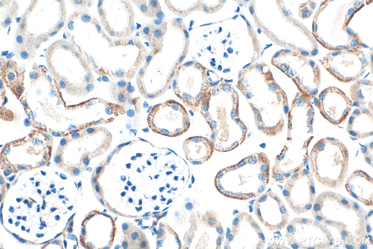 Immunohistochemistry (IHC) staining of mouse kidney tissue using L1CAM/CD171 Polyclonal antibody (31534-1-AP)