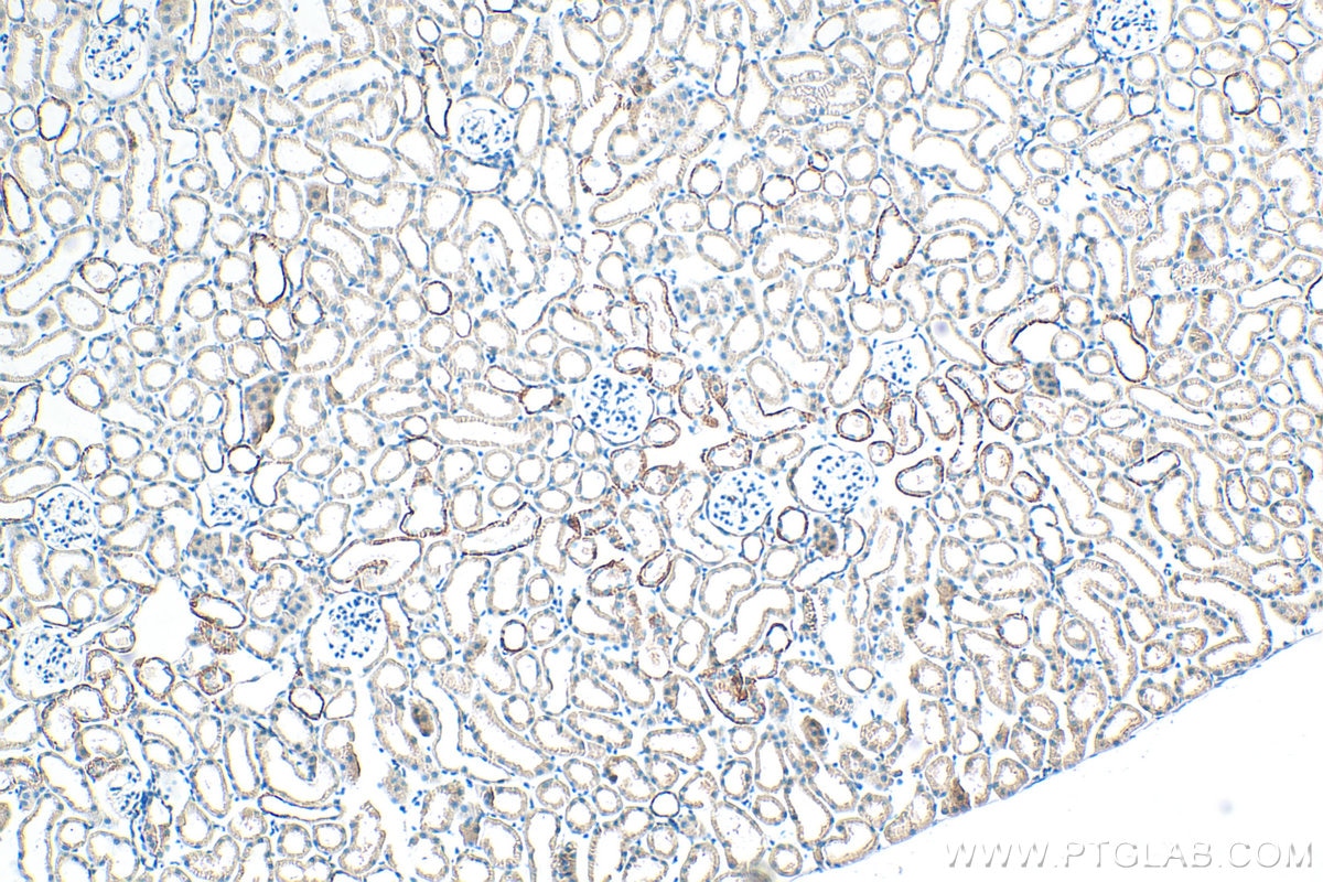 Immunohistochemistry (IHC) staining of mouse kidney tissue using L1CAM/CD171 Polyclonal antibody (31534-1-AP)