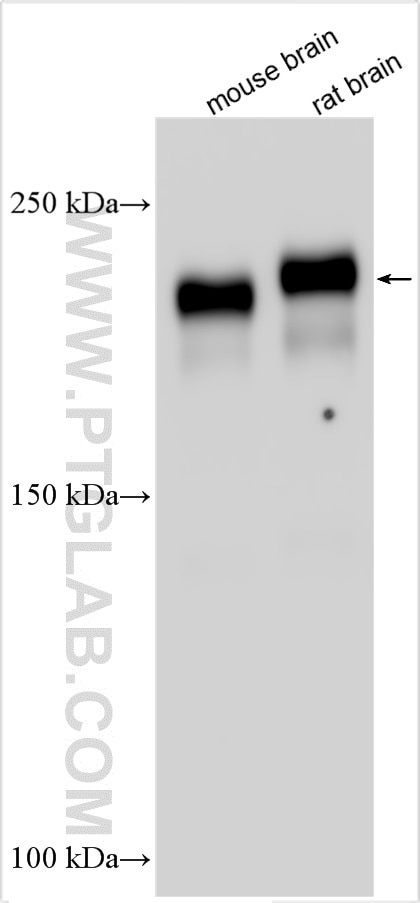 L1CAM/CD171