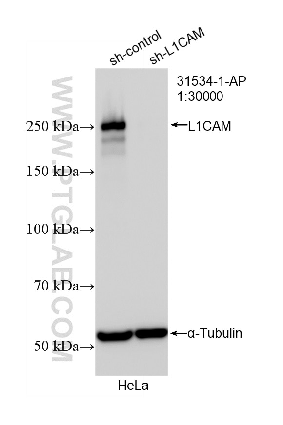 WB result of L1CAM/CD171 antibody (31534-1-AP; 1:30000; incubated at room temperature for 1.5 hours) with sh-Control and sh-L1CAM/CD171 transfected HeLa cells. Western Blot (WB) analysis of HeLa cells using L1CAM/CD171 Polyclonal antibody (31534-1-AP)