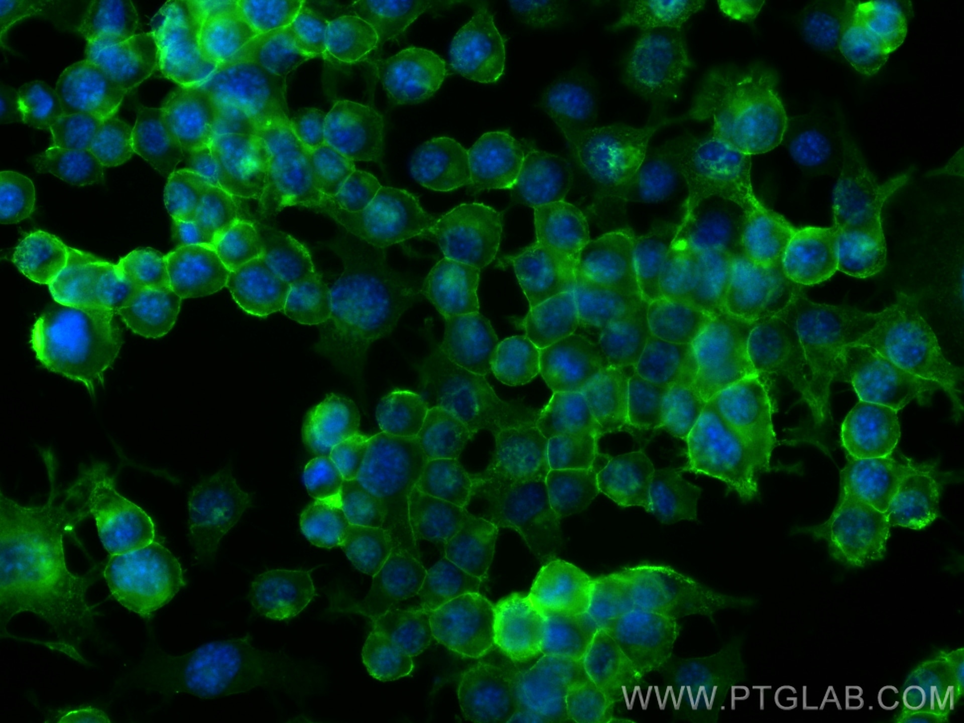 Immunofluorescent analysis of (-20°C Ethanol) fixed Neuro-2a cells using L1CAM antibody (32885-1-AP) at dilution of 1:400 and CoraLite®488-Conjugated Goat Anti-Rabbit IgG(H+L) (SA00013-2). Immunofluorescence (IF) / fluorescent staining of Neuro-2a cells using L1CAM/CD171 Polyclonal antibody (32885-1-AP)