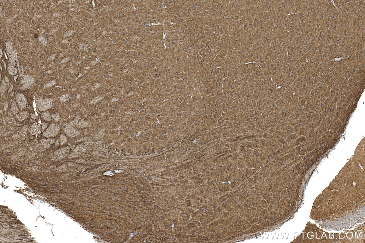 Immunohistochemistry (IHC) staining of mouse brain tissue using L1CAM Polyclonal antibody (32885-1-AP)