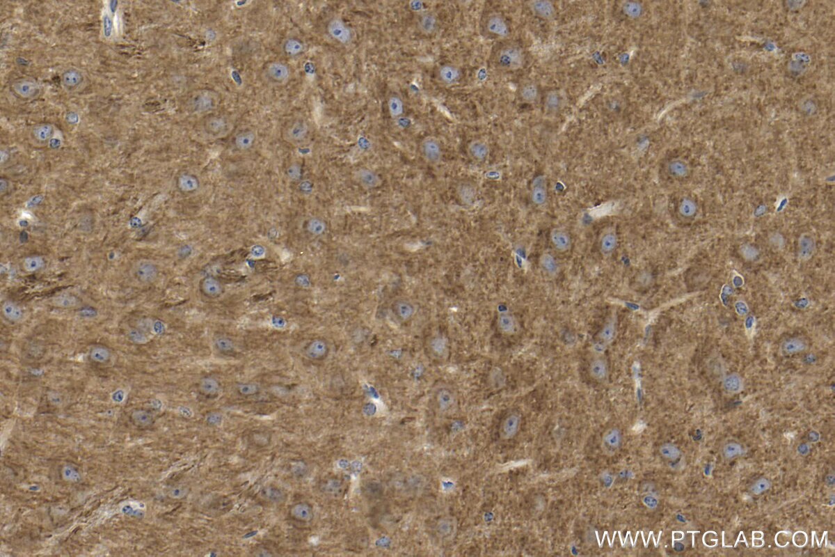 Immunohistochemistry (IHC) staining of mouse brain tissue using L1CAM Polyclonal antibody (32885-1-AP)