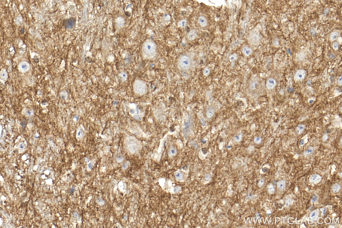 Immunohistochemistry (IHC) staining of mouse cerebellum tissue using L1CAM Polyclonal antibody (32885-1-AP)