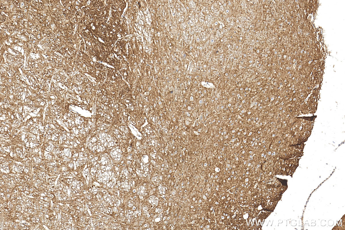 Immunohistochemistry (IHC) staining of mouse cerebellum tissue using L1CAM Polyclonal antibody (32885-1-AP)