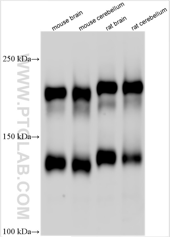 Western Blot (WB) analysis of various lysates using L1CAM Polyclonal antibody (32885-1-AP)