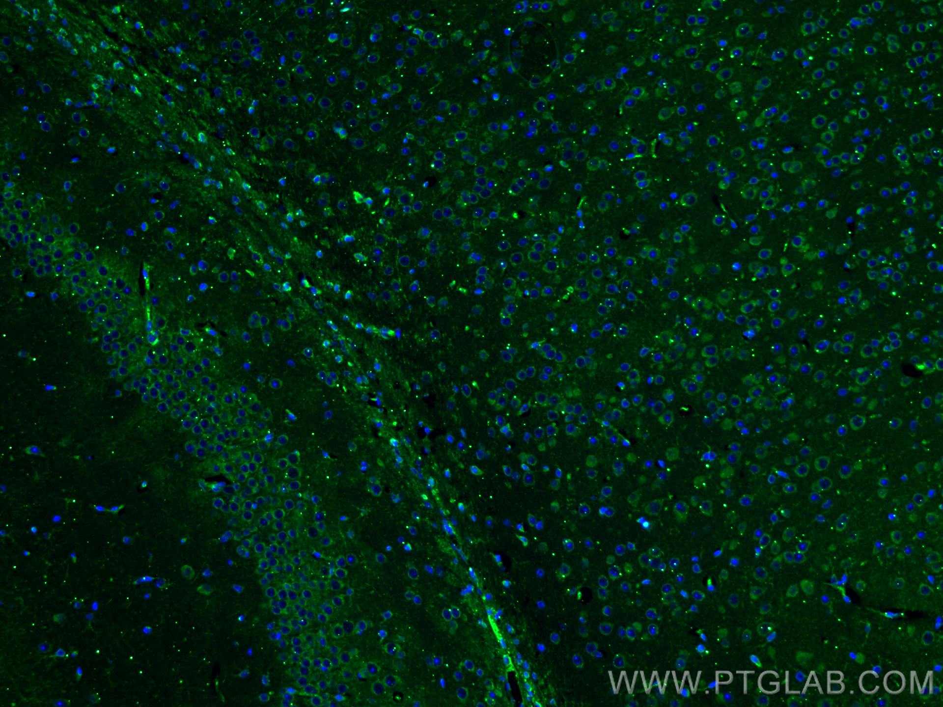 Immunofluorescence (IF) / fluorescent staining of mouse brain tissue using L1CAM Monoclonal antibody (67115-1-Ig)