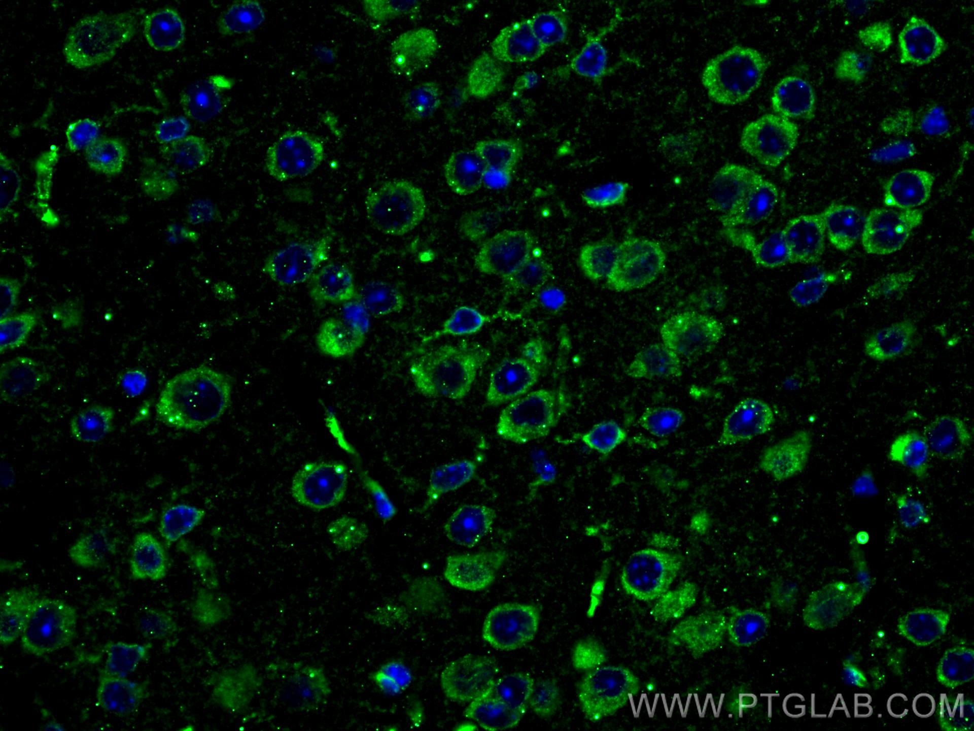 Immunofluorescence (IF) / fluorescent staining of mouse brain tissue using L1CAM Monoclonal antibody (67115-1-Ig)