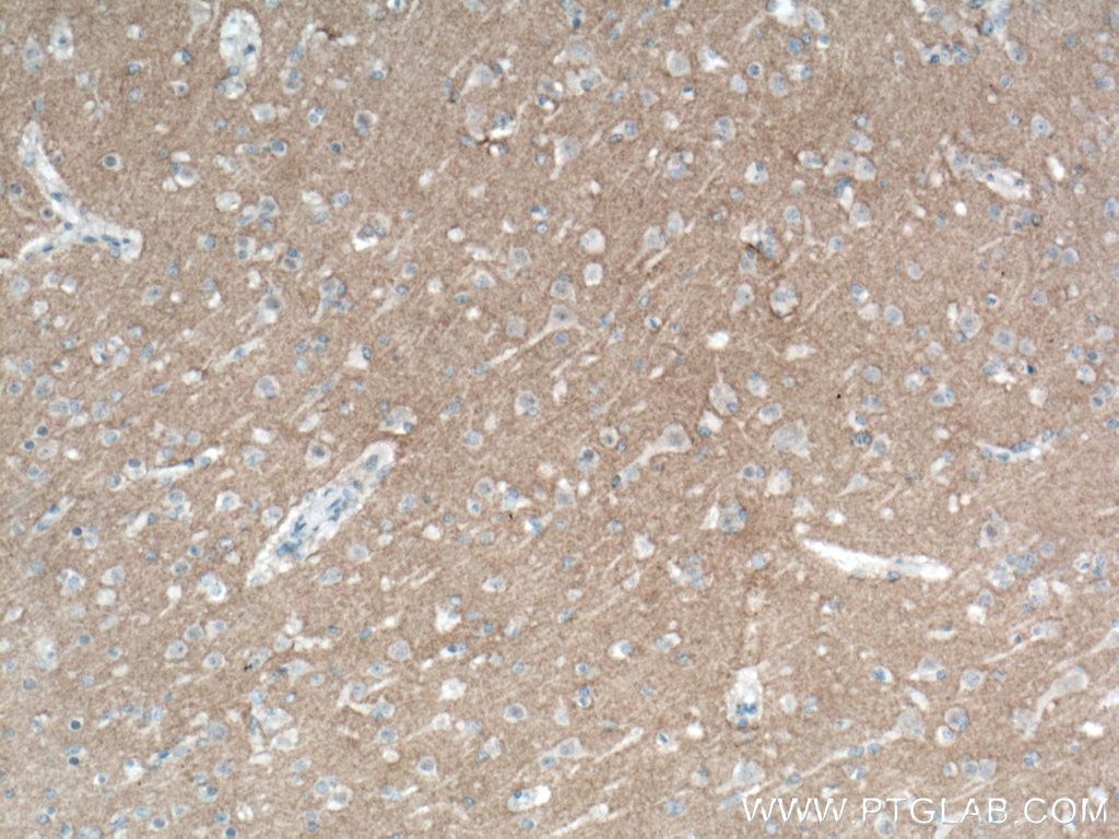 Immunohistochemistry (IHC) staining of human brain tissue using L1CAM Monoclonal antibody (67115-1-Ig)