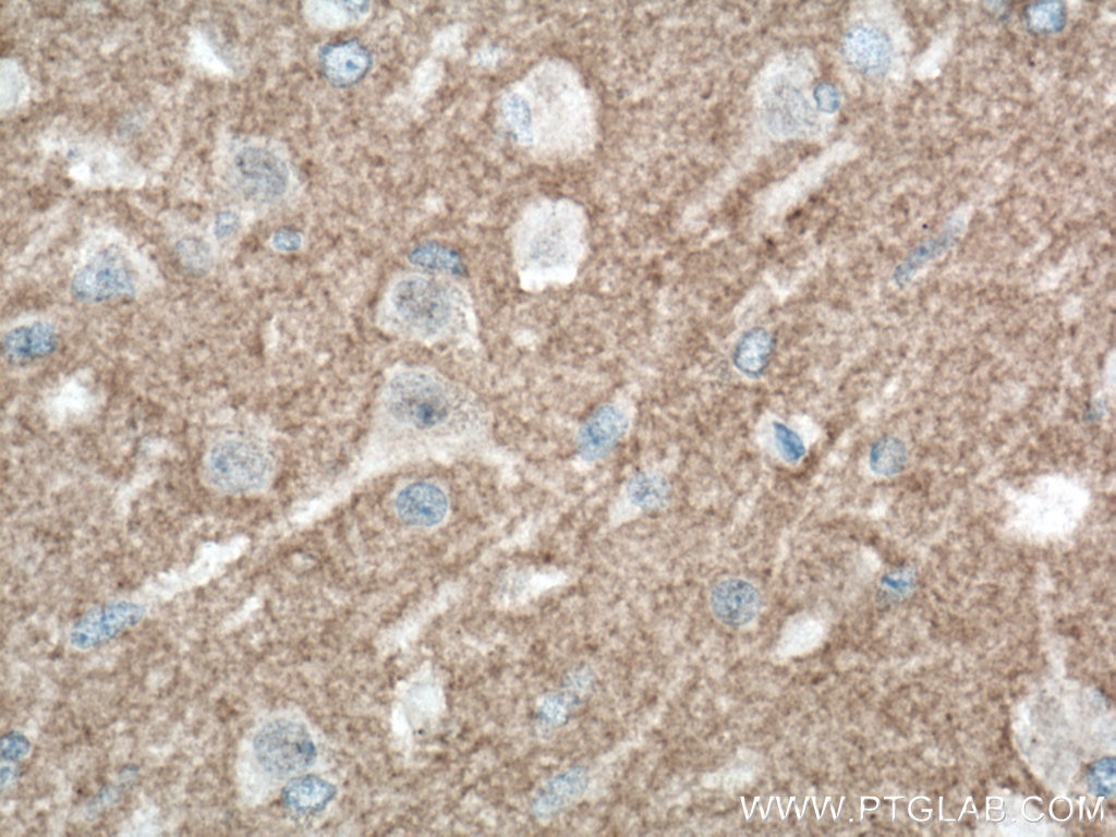 Immunohistochemistry (IHC) staining of human brain tissue using L1CAM Monoclonal antibody (67115-1-Ig)