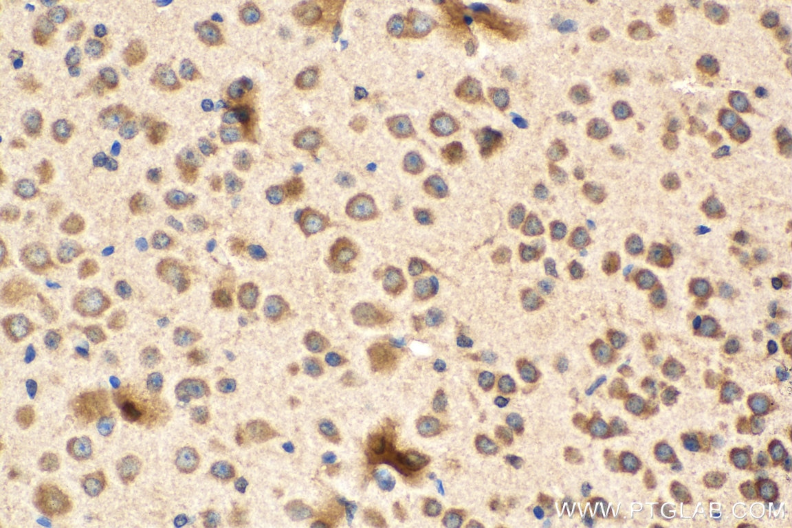 Immunohistochemistry (IHC) staining of mouse brain tissue using L1CAM Monoclonal antibody (67115-1-Ig)