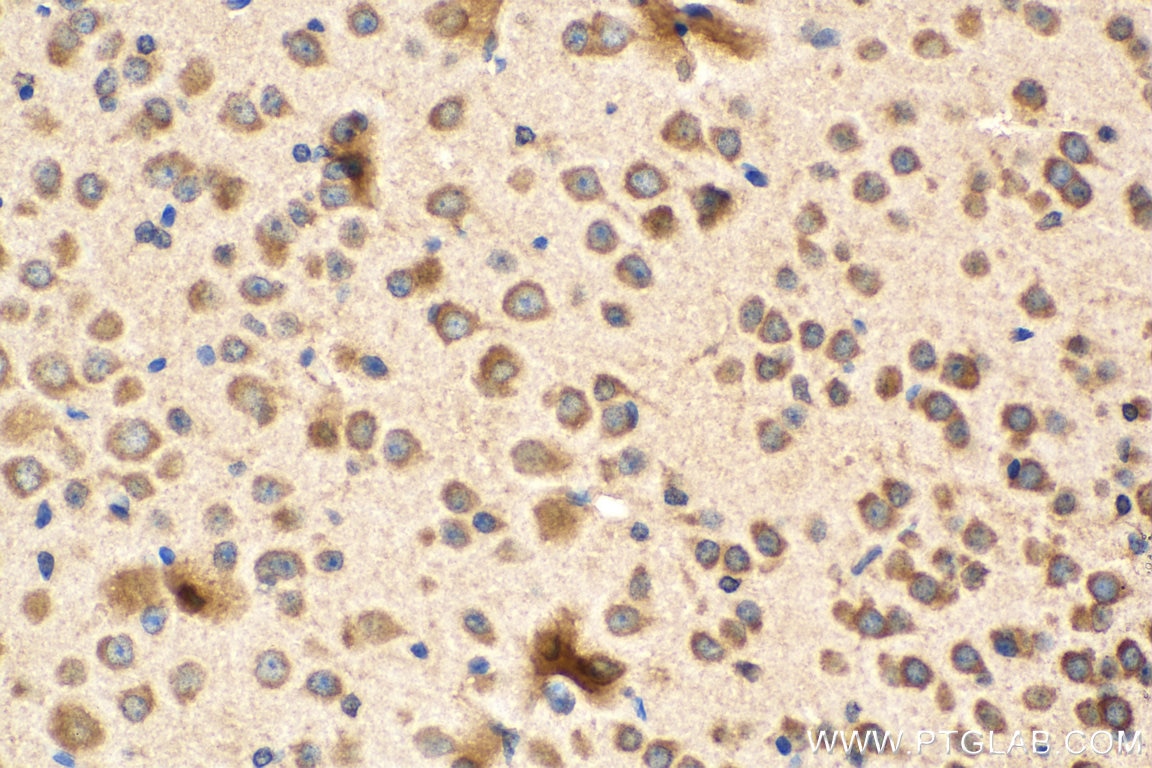 Immunohistochemistry (IHC) staining of mouse brain tissue using L1CAM Monoclonal antibody (67115-1-Ig)