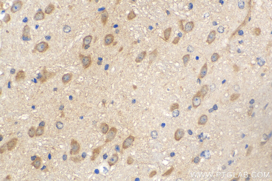 Immunohistochemistry (IHC) staining of mouse brain tissue using L1CAM Monoclonal antibody (67115-1-Ig)