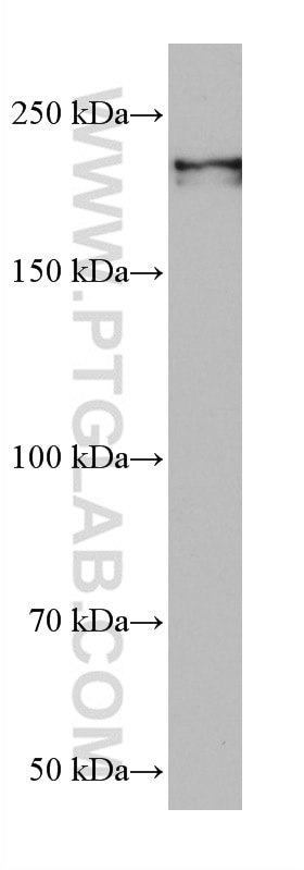 Western Blot (WB) analysis of pig cerebellum tissue using L1CAM Monoclonal antibody (67115-1-Ig)