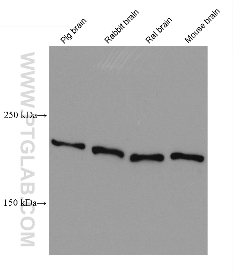 Western Blot (WB) analysis of various lysates using L1CAM Monoclonal antibody (67115-1-Ig)