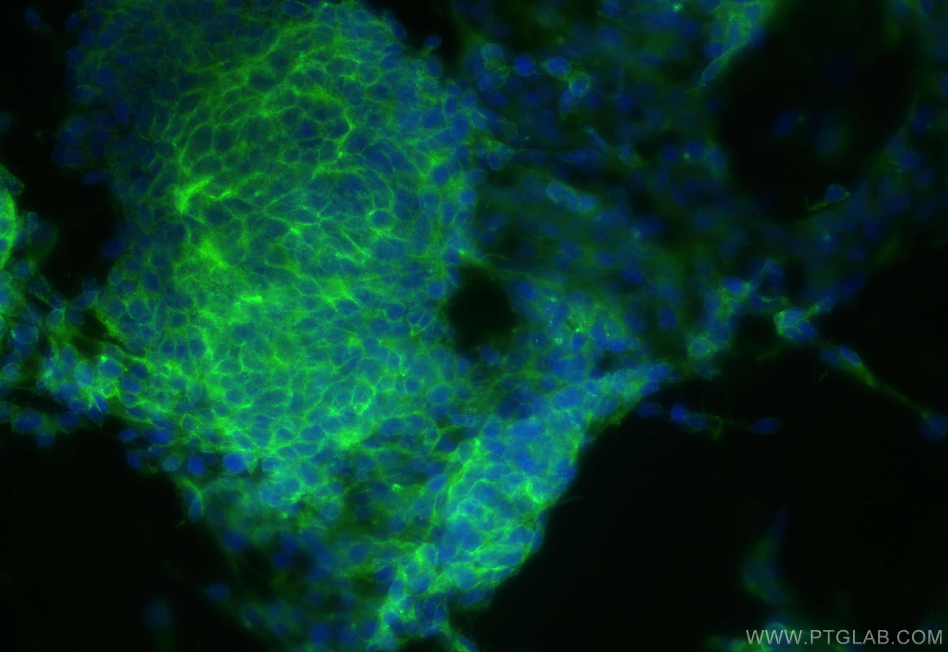 Immunofluorescence (IF) / fluorescent staining of SH-SY5Y cells using L1CAM Recombinant antibody (84034-5-RR)