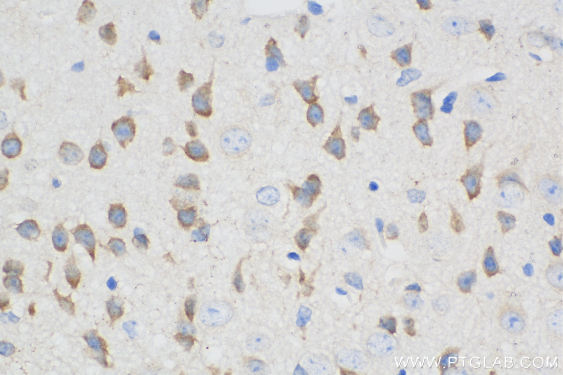 Immunohistochemistry (IHC) staining of mouse brain tissue using Biotin-conjugated L1CAM Monoclonal antibody (Biotin-67115)