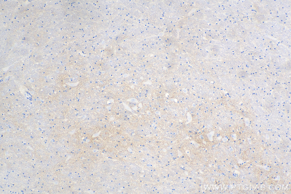 Immunohistochemistry (IHC) staining of human hypothalamus tissue using Biotin-conjugated L1CAM Monoclonal antibody (Biotin-67115)