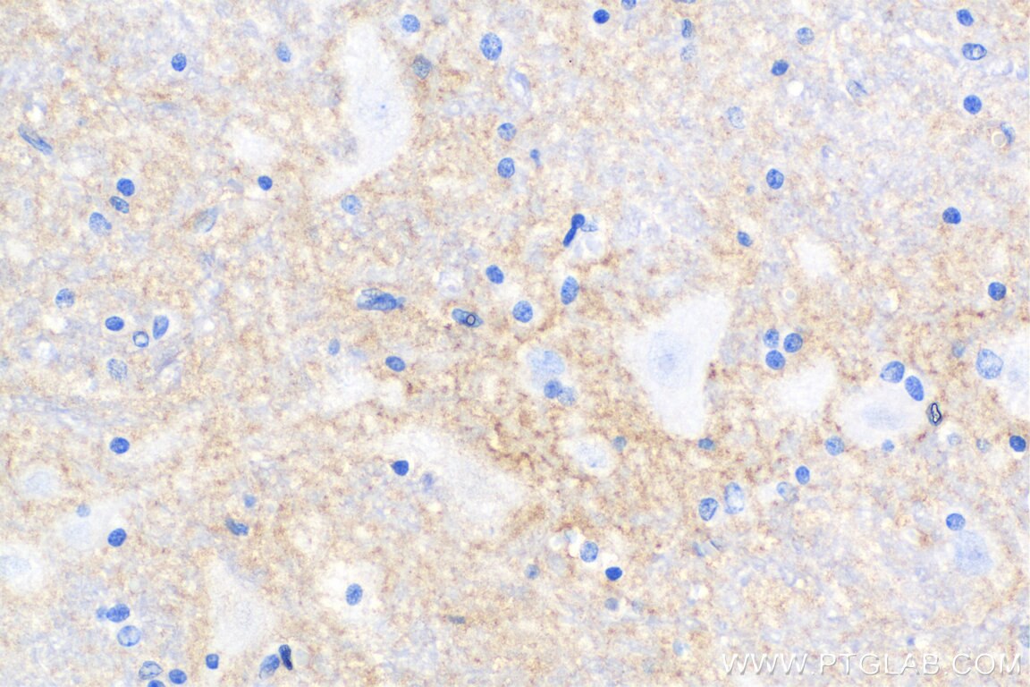 Immunohistochemistry (IHC) staining of human hypothalamus tissue using Biotin-conjugated L1CAM Monoclonal antibody (Biotin-67115)