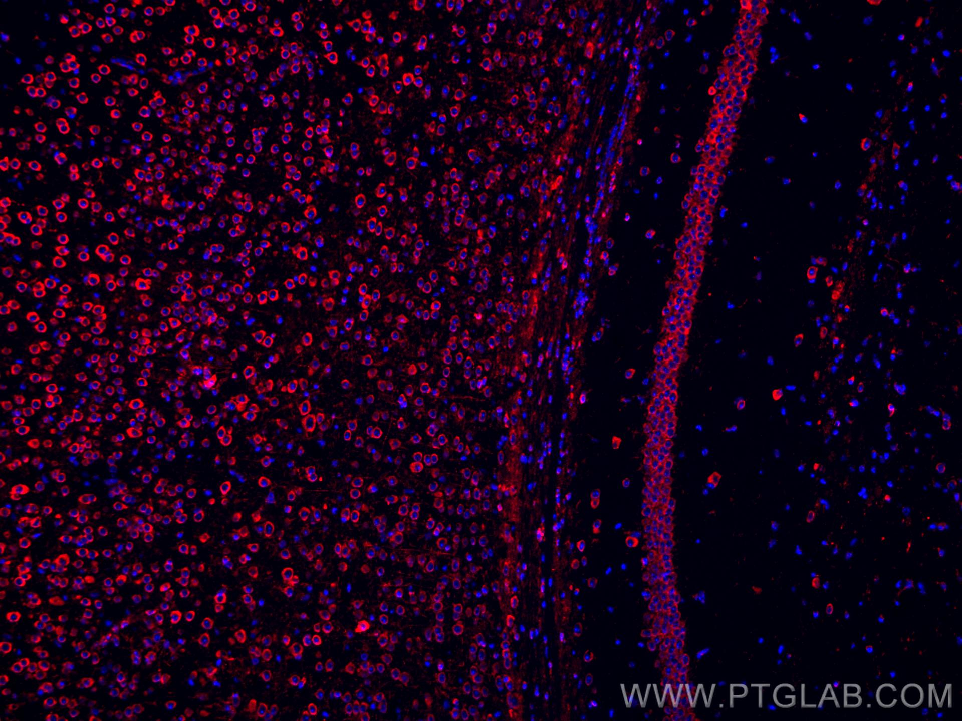 Immunofluorescence (IF) / fluorescent staining of mouse brain tissue using CoraLite®594-conjugated L1CAM Monoclonal antibody (CL594-67115)