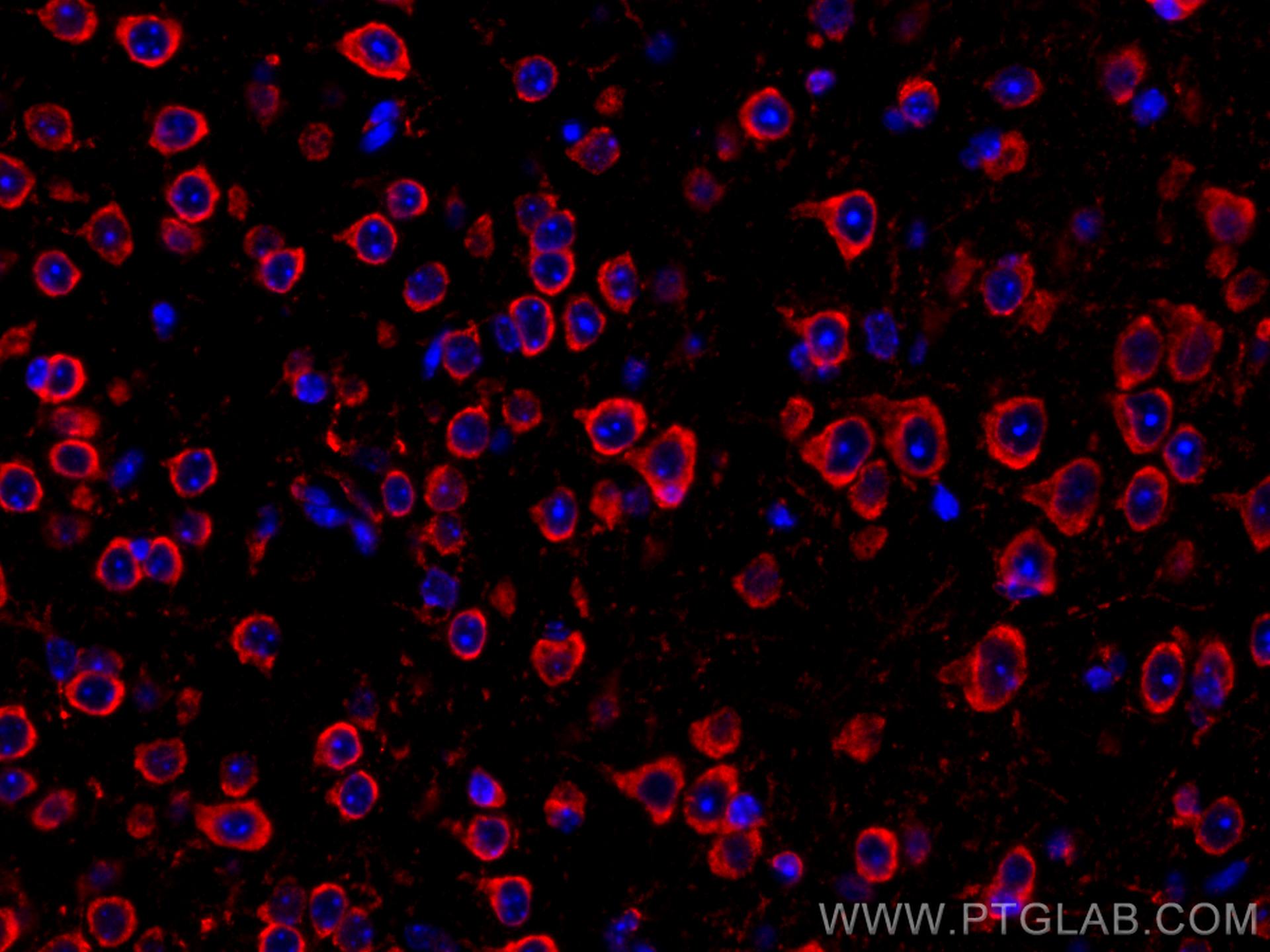 Immunofluorescence (IF) / fluorescent staining of mouse brain tissue using CoraLite®594-conjugated L1CAM Monoclonal antibody (CL594-67115)
