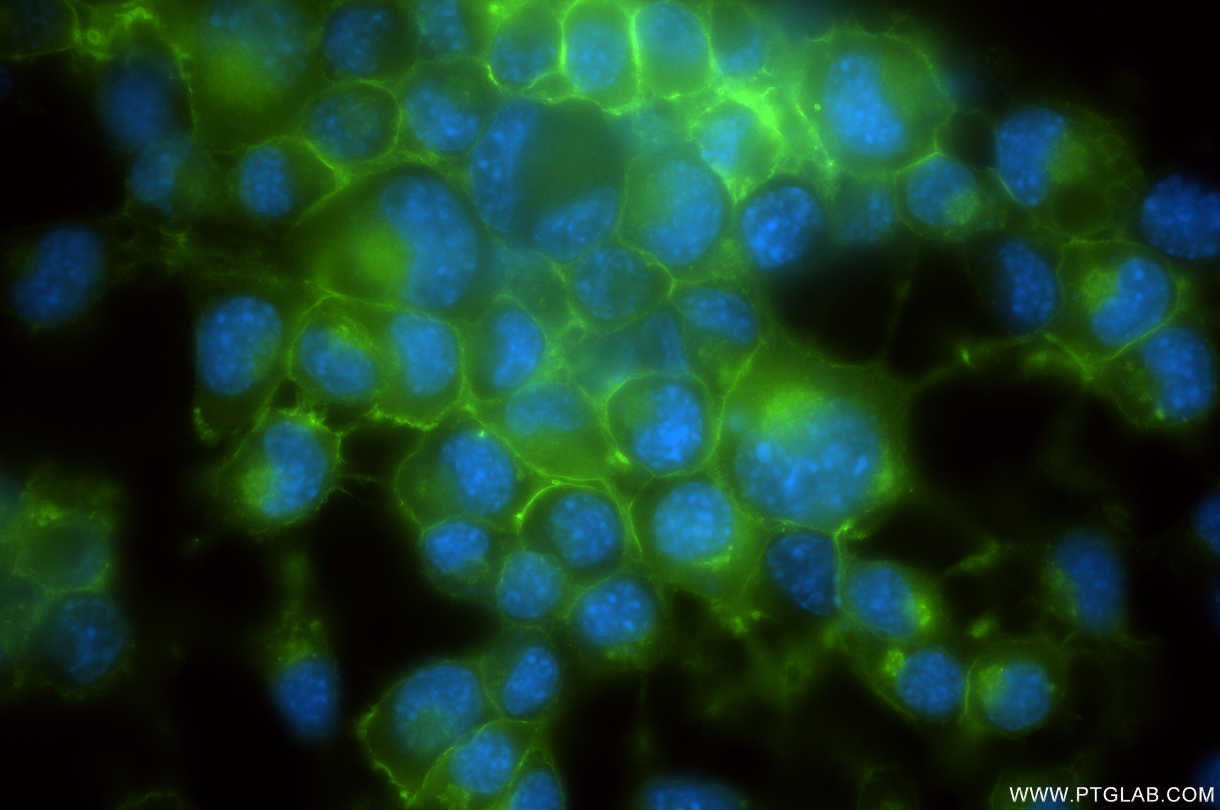Immunofluorescence (IF) / fluorescent staining of Neuro-2a cells using L1CAM/CD171 Recombinant antibody (86305-2-RR)