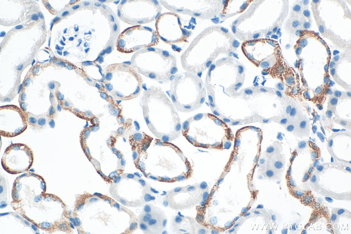Immunohistochemistry (IHC) staining of mouse kidney tissue using L1CAM/CD171 Recombinant antibody (86305-2-RR)