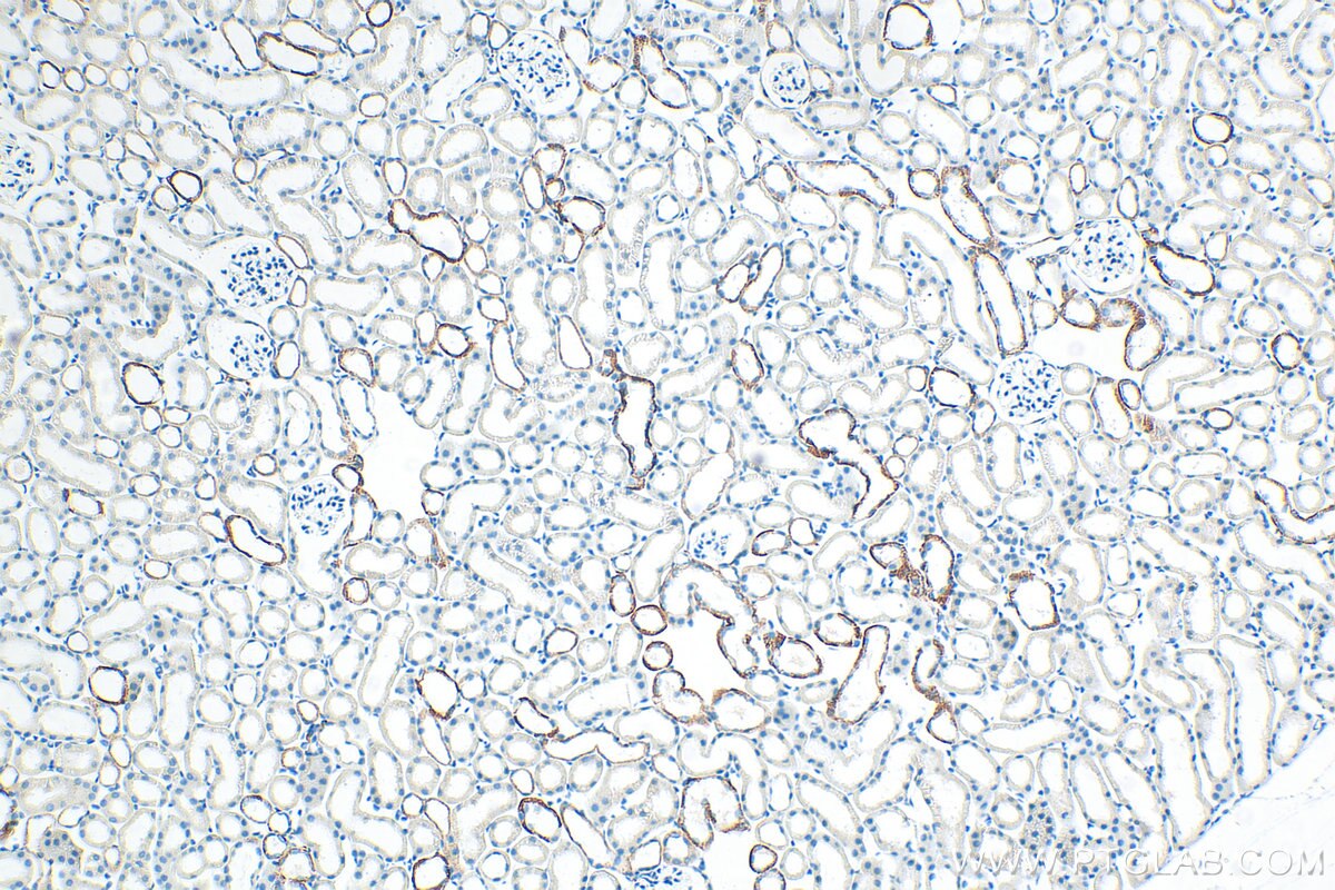 Immunohistochemistry (IHC) staining of mouse kidney tissue using L1CAM/CD171 Recombinant antibody (86305-2-RR)