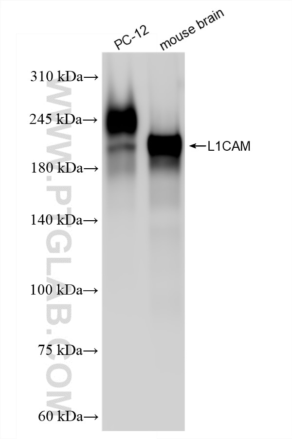 Western Blot (WB) analysis of various lysates using L1CAM/CD171 Recombinant antibody (86305-2-RR)