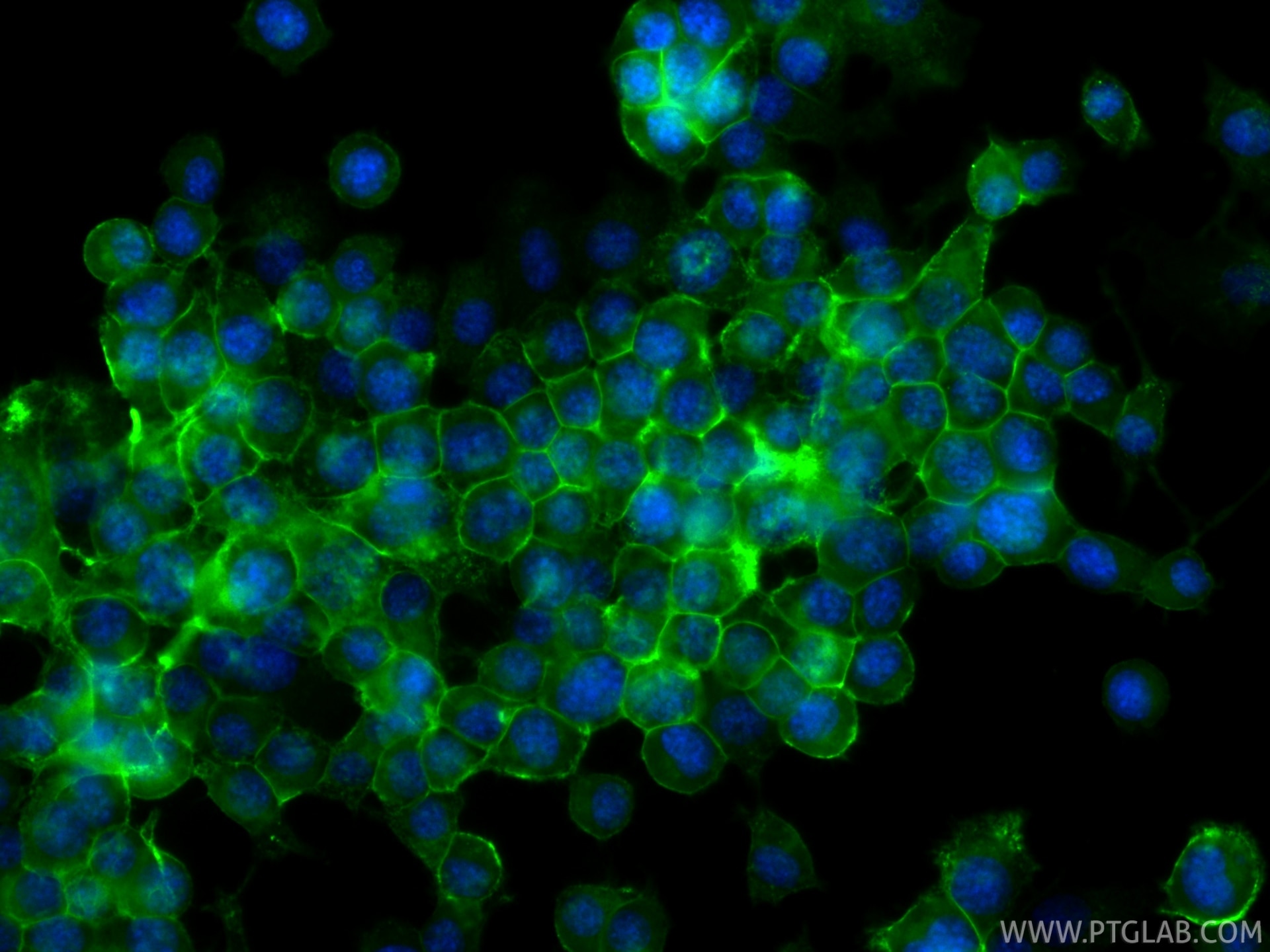 Immunofluorescence (IF) / fluorescent staining of Neuro-2a cells using CoraLite® Plus 488-conjugated L1CAM/CD171 Recombin (CL488-86305-2)