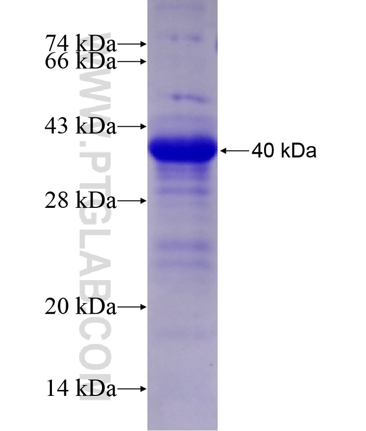 L1CAM fusion protein Ag17706 SDS-PAGE