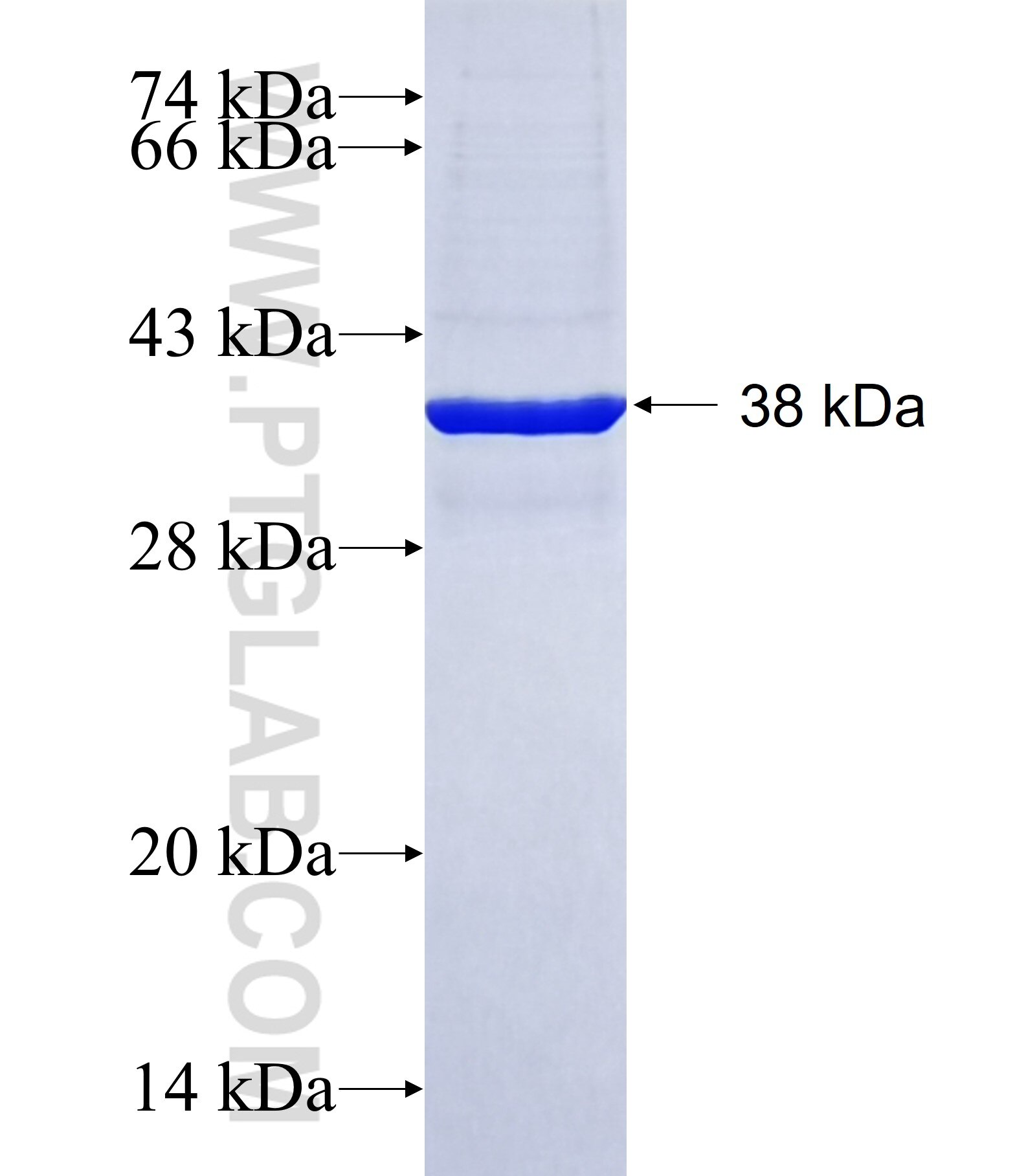 L1RE1 fusion protein Ag40879 SDS-PAGE L1RE1 fusion protein Ag40879 SDS-PAGE