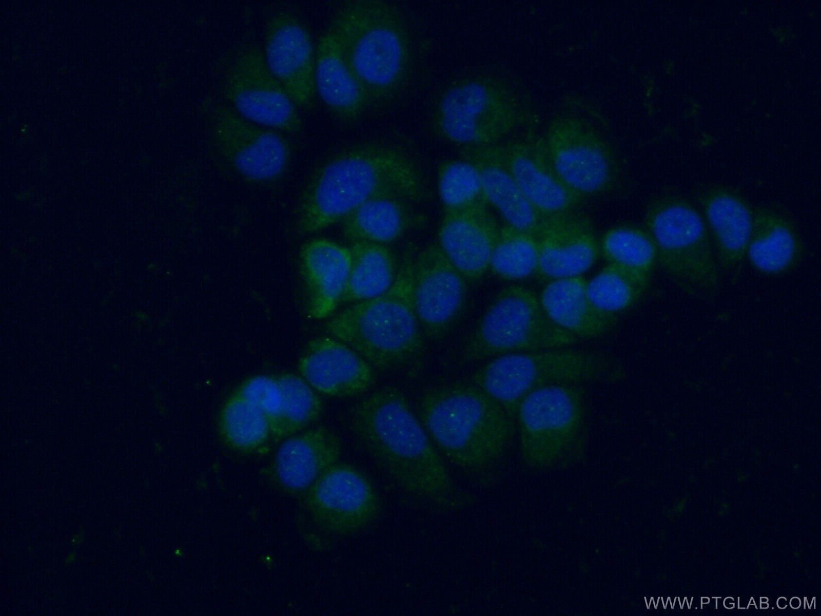 Immunofluorescence (IF) / fluorescent staining of NCCIT cells using L1TD1 Polyclonal antibody (21528-1-AP)