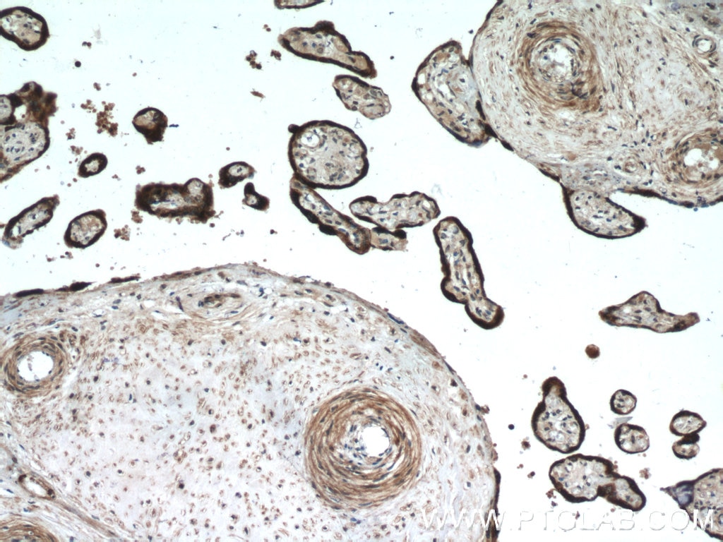 Immunohistochemistry (IHC) staining of human placenta tissue using L1TD1 Polyclonal antibody (21528-1-AP)