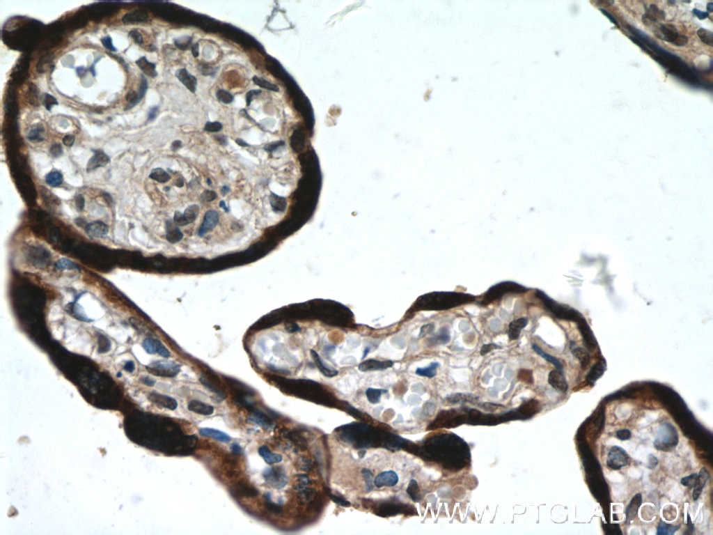 Immunohistochemistry (IHC) staining of human placenta tissue using L1TD1 Polyclonal antibody (21528-1-AP)