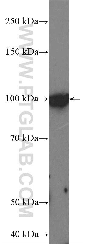 Western Blot (WB) analysis of NCCIT cells using L1TD1 Polyclonal antibody (21528-1-AP)