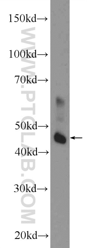 Western Blot (WB) analysis of rat brain tissue using L2HGDH Polyclonal antibody (15707-1-AP)