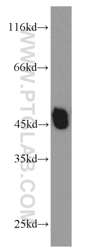 Western Blot (WB) analysis of SGC-7901 cells using L2HGDH Polyclonal antibody (15707-1-AP)