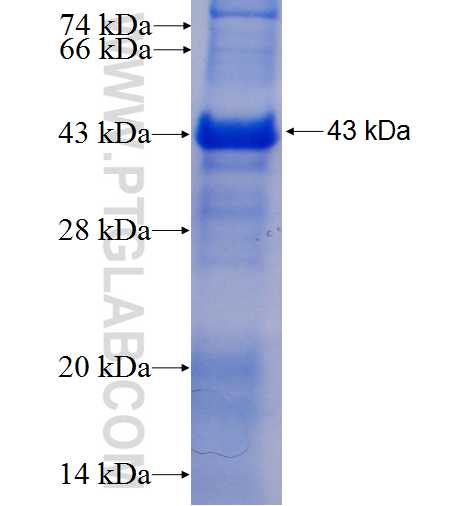 L3MBTL fusion protein Ag5326 SDS-PAGE
