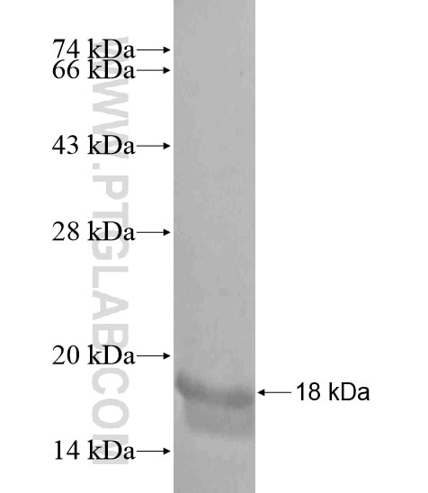L3MBTL2 fusion protein Ag19571 SDS-PAGE