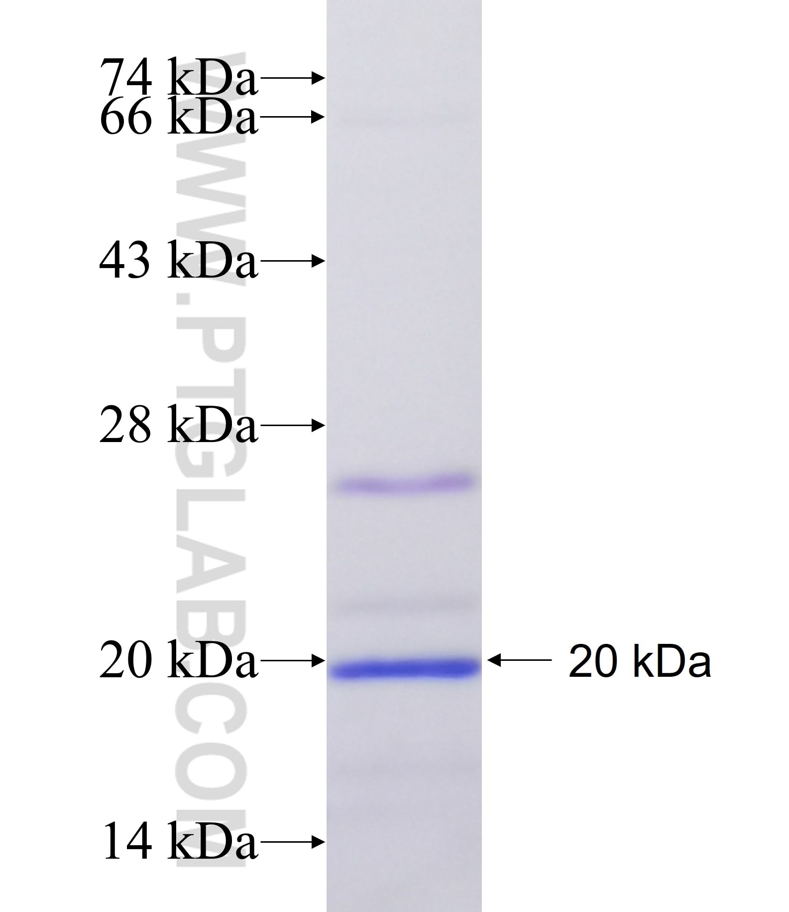 L3MBTL2 fusion protein Ag19571 SDS-PAGE