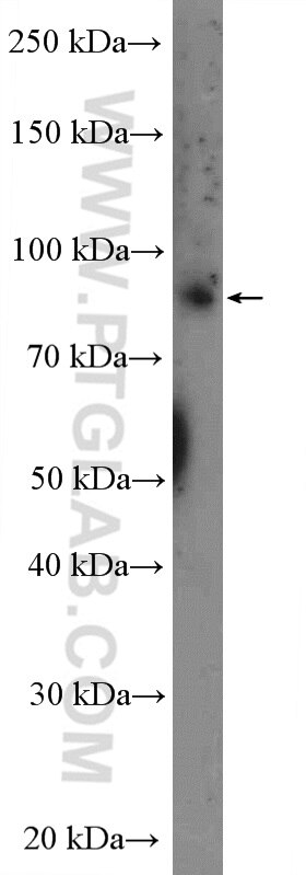 Western Blot (WB) analysis of Jurkat cells using L3MBTL3 Polyclonal antibody (14070-1-AP)