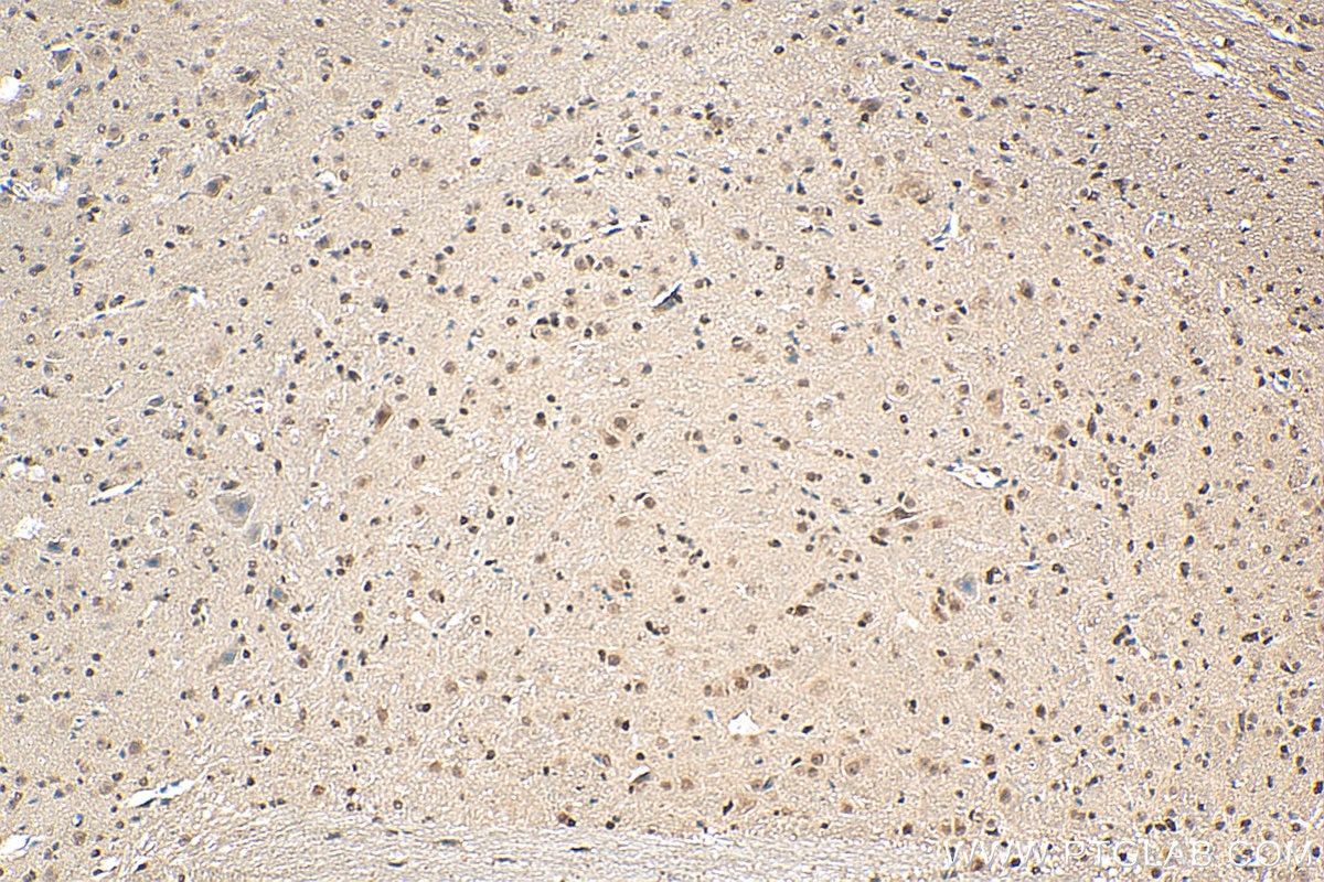 Immunohistochemistry (IHC) staining of mouse cerebellum tissue using L3MBTL3 Polyclonal antibody (28112-1-AP)